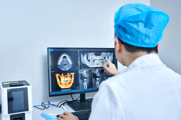 Best Emergency Root Canal Treatment in Llender, CA